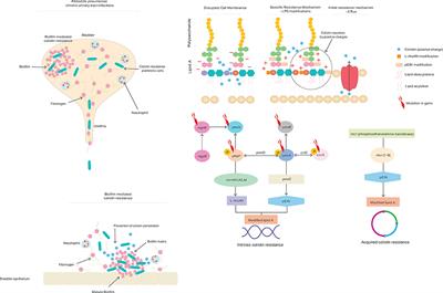 Will There Ever Be Cure for Chronic, Life-Changing Colistin-Resistant Klebsiella pneumoniae in Urinary Tract Infection?